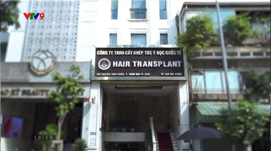 cấy tóc trị hói