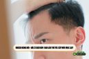Khách hàng hỏi – Bác sĩ giải đáp: Bao lâu thì tóc cấy mới mọc lại? 