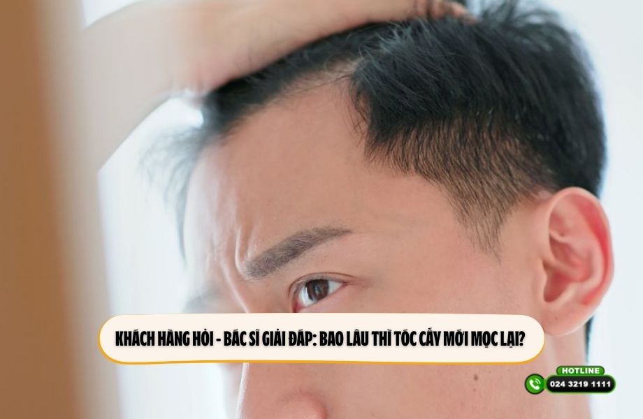 Khách hàng hỏi – Bác sĩ giải đáp: Bao lâu thì tóc cấy mới mọc lại? 
