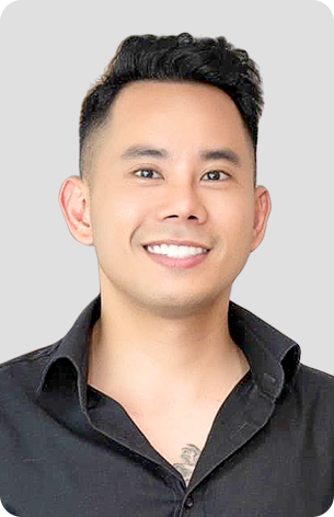 cấy tóc trị hói