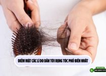 Điểm mặt các lí do dẫn tới rụng tóc phổ biến nhất