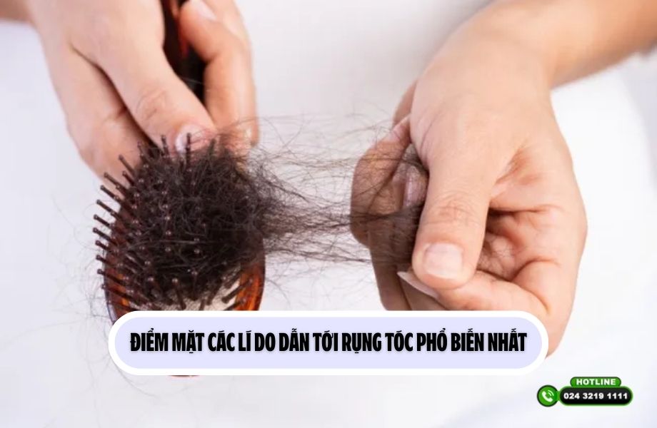 Điểm mặt các lí do dẫn tới rụng tóc phổ biến nhất