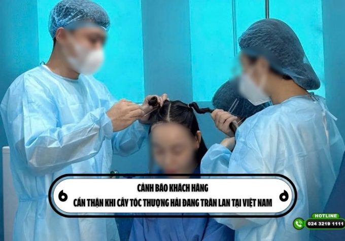 Cảnh báo khách hàng: Cẩn thận khi cấy tóc Thượng Hải đang tràn lan tại Việt Nam