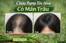 Chữa rụng tóc bằng cỏ mần trầu có thực sự hiệu quả?
