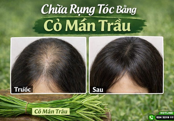 Chữa rụng tóc bằng cỏ mần trầu có thực sự hiệu quả?