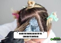 Da đầu tổn thương sau khi tẩy tóc: Cảnh báo từ chuyên gia