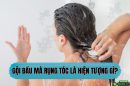 Gội đầu mà rụng tóc là hiện tượng gì? – Bác sĩ lý giải nguyên nhân