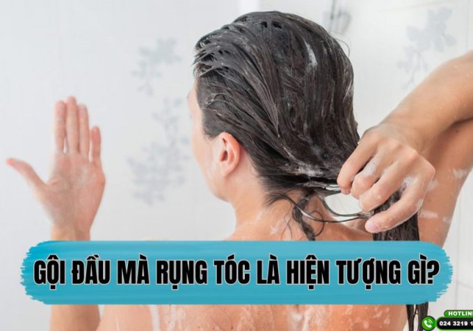 Gội đầu mà rụng tóc là hiện tượng gì? – Bác sĩ lý giải nguyên nhân