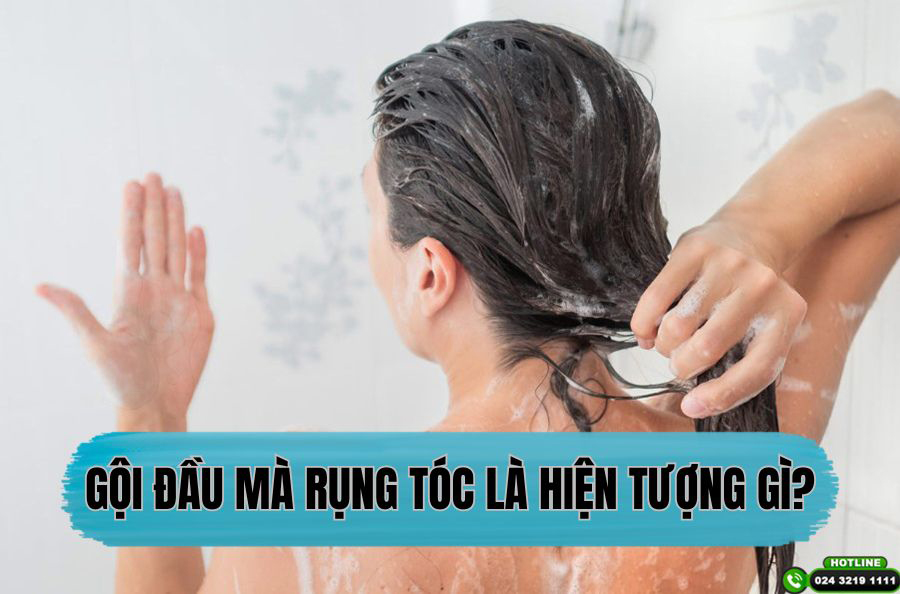 Gội đầu mà rụng tóc là hiện tượng gì? – Bác sĩ lý giải nguyên nhân