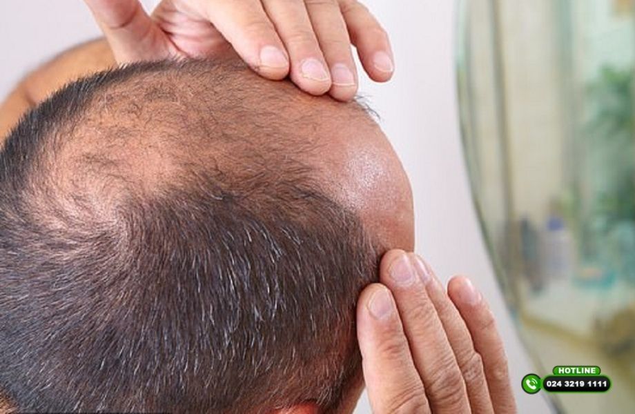 Làm PRP bao lâu mọc tóc? Sự thật không phải ai cũng biết