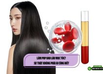 Làm PRP bao lâu mọc tóc? Sự thật không phải ai cũng biết