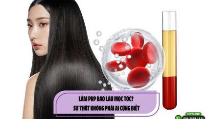 Làm PRP bao lâu mọc tóc? Sự thật không phải ai cũng biết