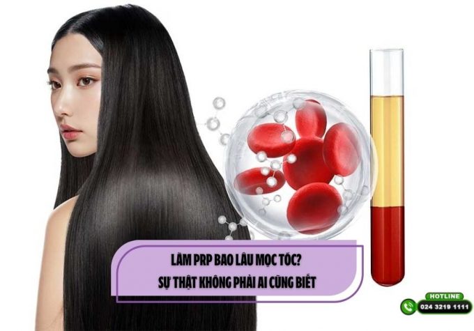 Làm PRP bao lâu mọc tóc? Sự thật không phải ai cũng biết