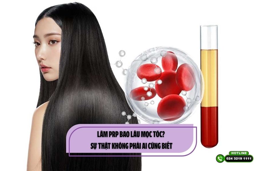 Làm PRP bao lâu mọc tóc? Sự thật không phải ai cũng biết