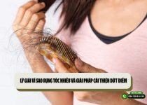 Lý giải vì sao rụng tóc nhiều và giải pháp cải thiện dứt điểm