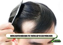 Những nguyên nhân rụng tóc thường gặp và cách phòng ngừa 