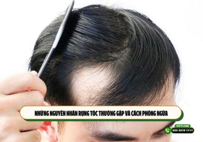 Những nguyên nhân rụng tóc thường gặp và cách phòng ngừa 