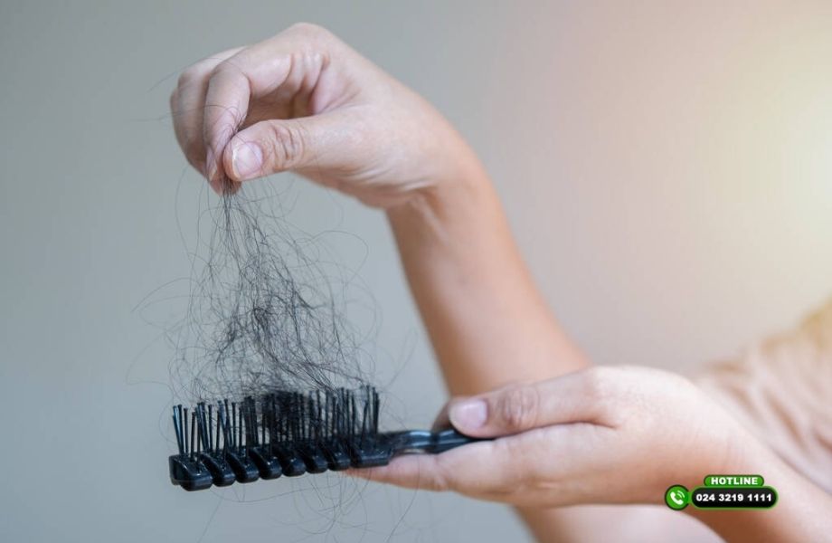 Tìm hiểu nguyên nhân và điều trị rụng tóc ở mọi lứa tuổi