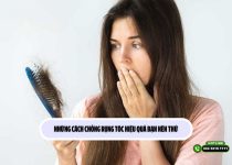 Những cách chống rụng tóc hiệu quả bạn nên thử