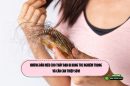 Những dấu hiệu cho thấy bạn bị rụng tóc nghiêm trọng và cần can thiệp sớm