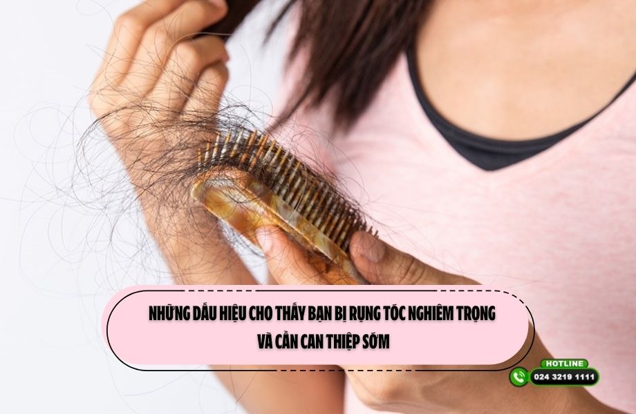 Những dấu hiệu cho thấy bạn bị rụng tóc nghiêm trọng và cần can thiệp sớm