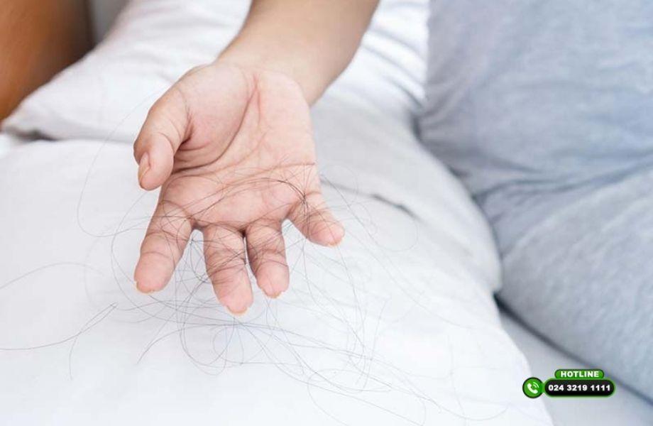 Những dấu hiệu cho thấy bạn bị rụng tóc nghiêm trọng và cần can thiệp sớm
