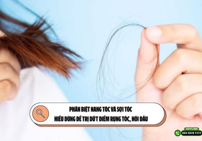 Phân biệt nang tóc và sợi tóc: Hiểu đúng để trị dứt điểm rụng tóc, hói đầu