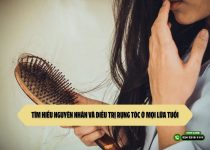 Tìm hiểu nguyên nhân và điều trị rụng tóc ở mọi lứa tuổi