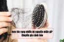 Xem tóc rụng nhiều do nguyên nhân gì? Chuyên gia cảnh báo 10 lý do phổ biến nhất