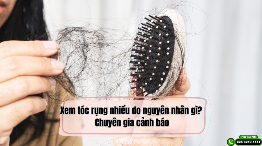 Xem tóc rụng nhiều do nguyên nhân gì? Chuyên gia cảnh báo 10 lý do phổ biến nhất