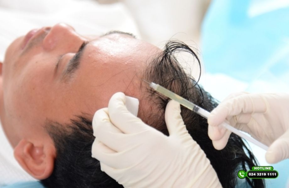 Làm PRP bao lâu mọc tóc? Sự thật không phải ai cũng biết