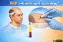 PRP có dùng cho người cấy tóc không? Hiểu đúng để tối ưu hiệu quả