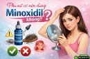 Phụ nữ có nên dùng Minoxidil không? Hiệu quả và rủi ro cần cân nhắc