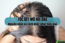 Tóc bết mồ hôi dầu: Nguyên nhân và cách khắc phục hiệu quả