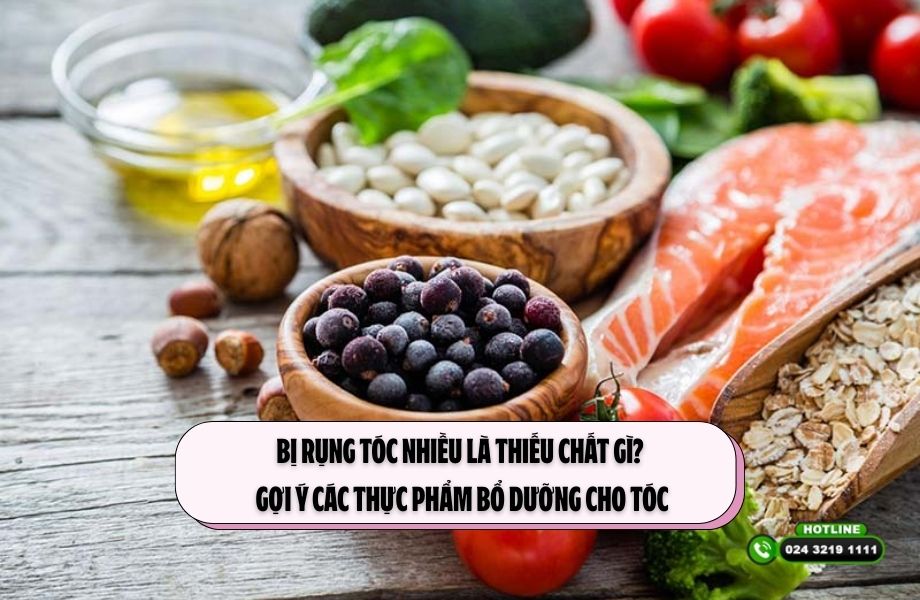 Bị rụng tóc nhiều là thiếu chất gì? Gợi ý các thực phẩm bổ dưỡng cho tóc