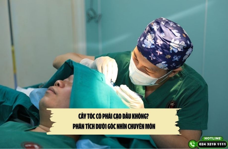 Cấy tóc có phải cạo đầu không? Phân tích dưới góc nhìn chuyên môn