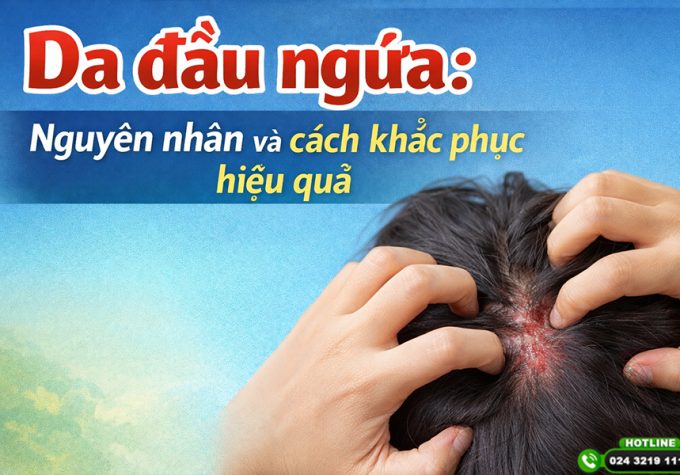 Da đầu ngứa: Nguyên nhân và cách khắc phục hiệu quả