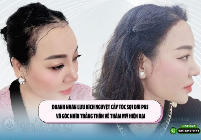 Doanh nhân Lưu Bích Nguyệt cấy tóc sợi dài PNS và góc nhìn thẳng thắn về thẩm mỹ hiện đại