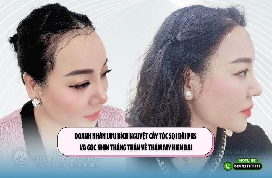 Doanh nhân Lưu Bích Nguyệt cấy tóc sợi dài PNS và góc nhìn thẳng thắn về thẩm mỹ hiện đại