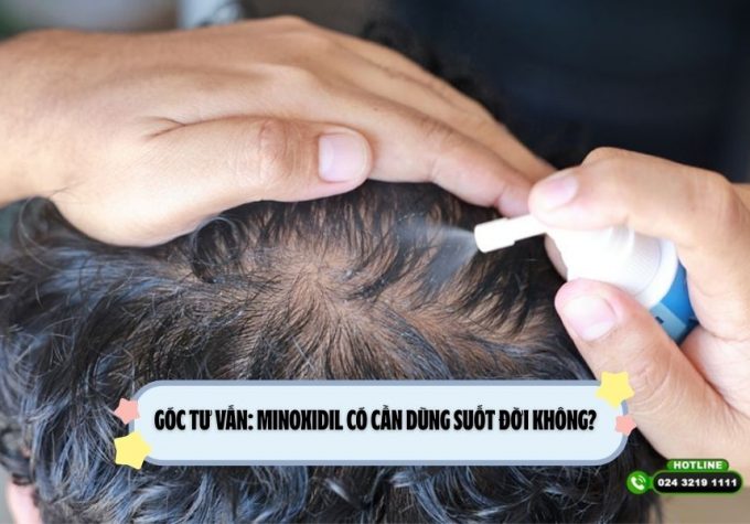 Góc tư vấn: Minoxidil có cần dùng suốt đời không?