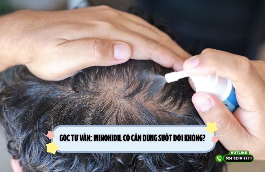 Góc tư vấn: Minoxidil có cần dùng suốt đời không?