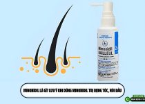 Minoxidil là gì? Lưu ý khi dùng Minoxidil trị rụng tóc, hói đầu