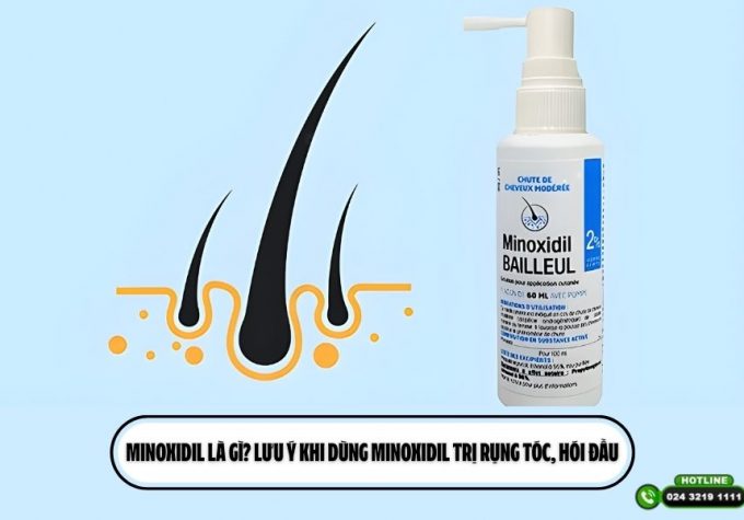 Minoxidil là gì? Lưu ý khi dùng Minoxidil trị rụng tóc, hói đầu