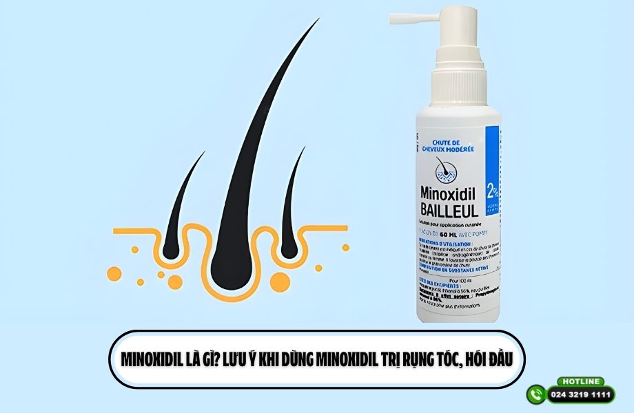 Minoxidil là gì? Lưu ý khi dùng Minoxidil trị rụng tóc, hói đầu