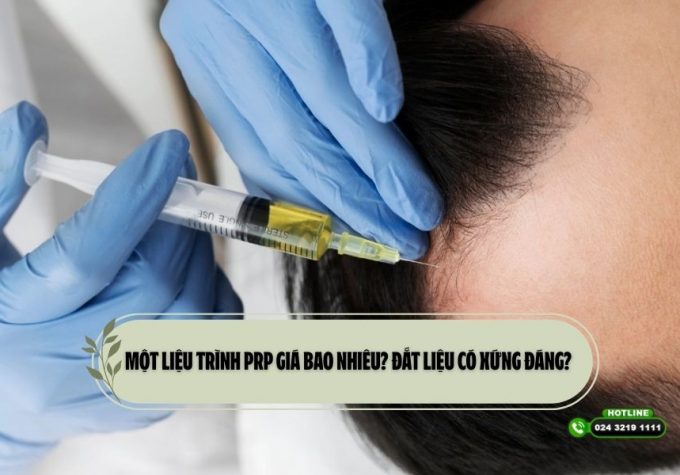 Một liệu trình PRP giá bao nhiêu? Đắt liệu có xứng đáng?
