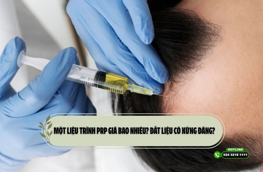Một liệu trình PRP giá bao nhiêu? Đắt liệu có xứng đáng?