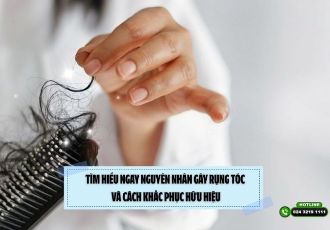 Tìm hiểu ngay nguyên nhân gây rụng tóc và cách khắc phục hữu hiệu