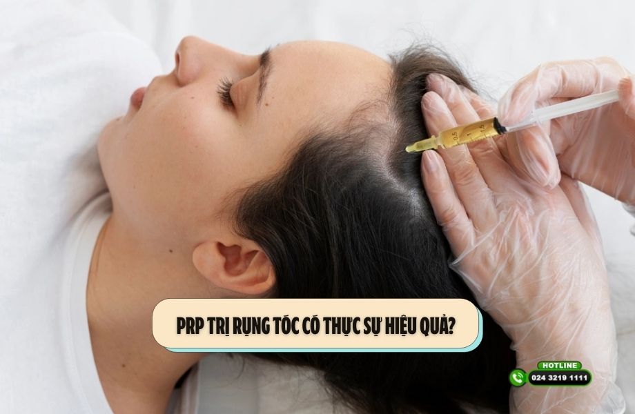 PRP trị rụng tóc có thực sự hiệu quả? 