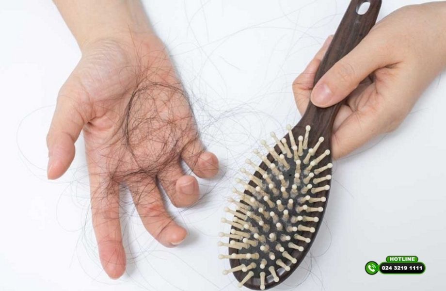 Góc tư vấn: Minoxidil có cần dùng suốt đời không?