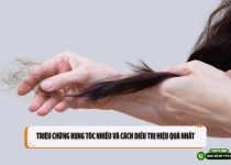 Triệu chứng rụng tóc nhiều và cách điều trị hiệu quả nhất